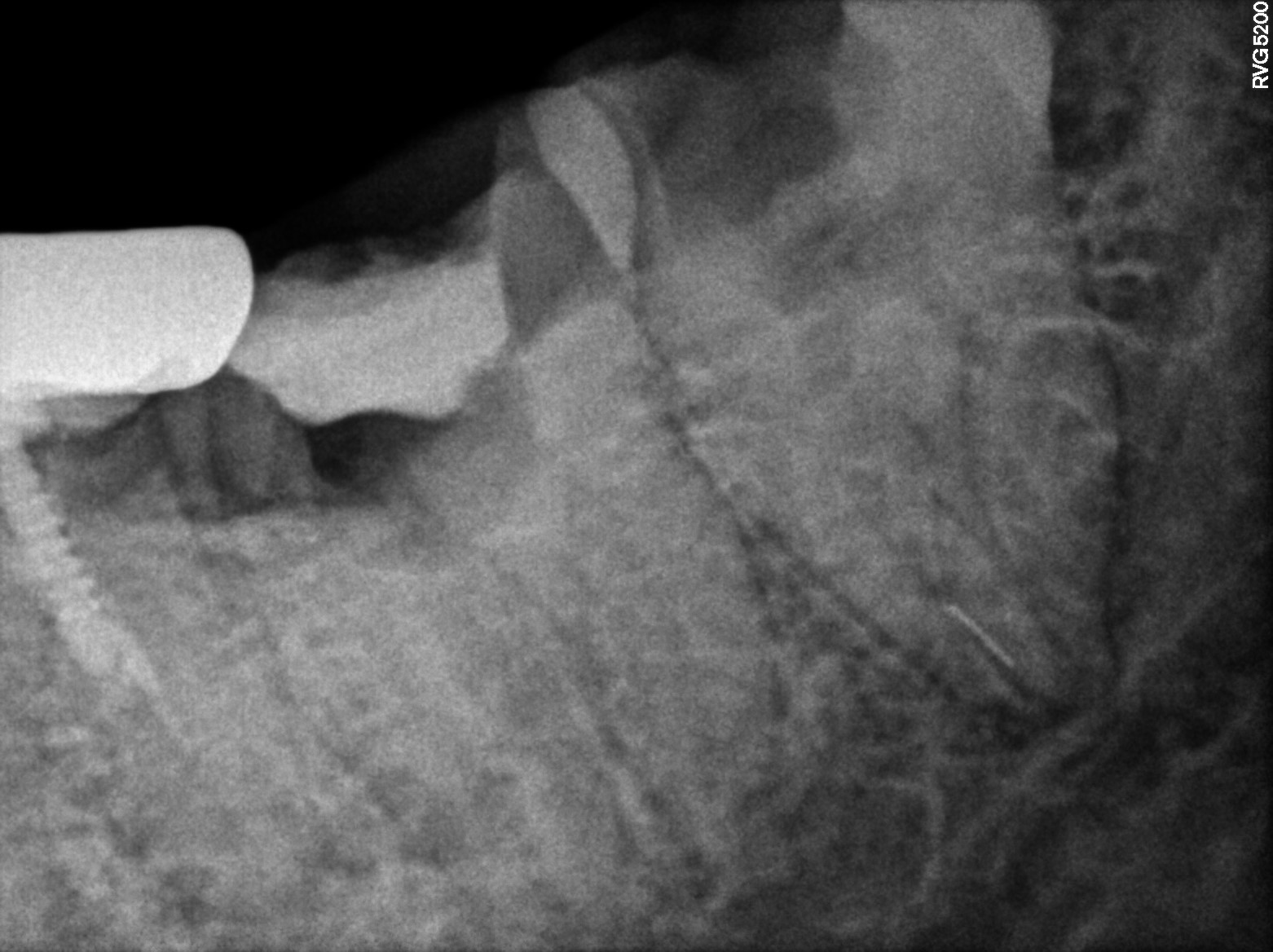 Dental X-ray